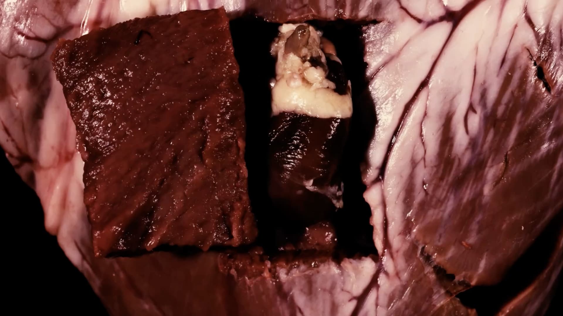 Visceral